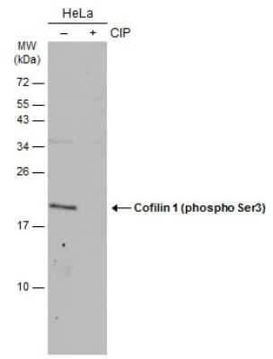 Western Blot: Cofilin [p Ser3] Antibody [NBP3-13302]